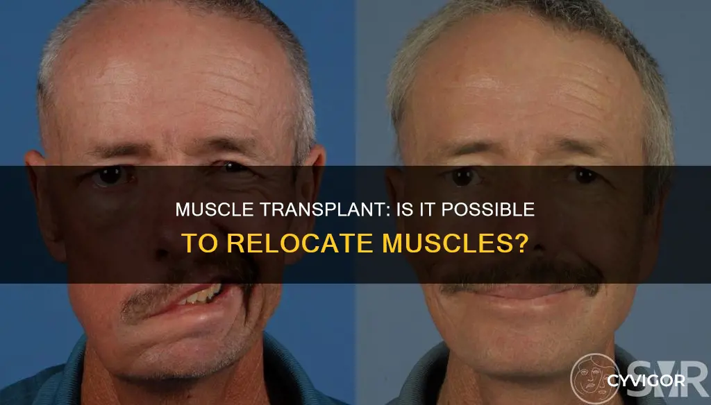 is muscle transplant possible