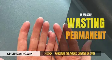 Muscle Wasting: Can It Be Reversed or Is It Permanent?