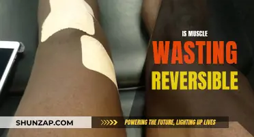 Reversing Muscle Wasting: Is It Possible?