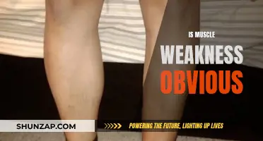 Muscle Weakness: Is It Always Visible?
