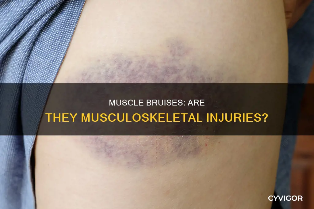 is muscloskelital a muscle brusie