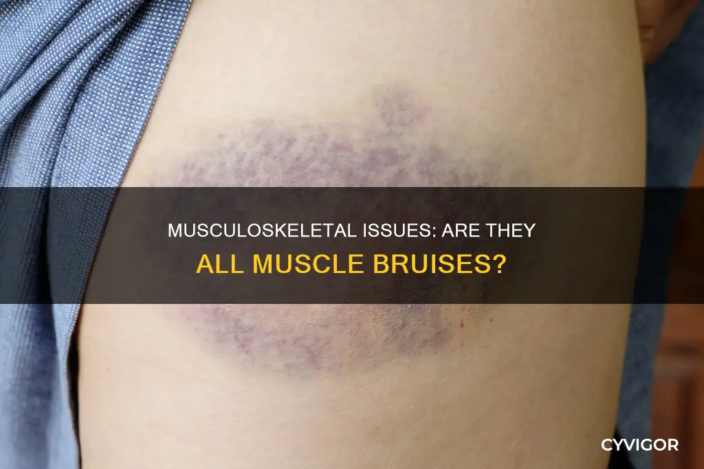 is musculoskeletal a muscle bruise