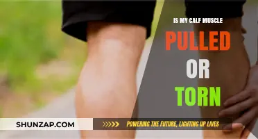 Pulled or Torn Calf Muscle: Symptoms, Causes, and Recovery Tips