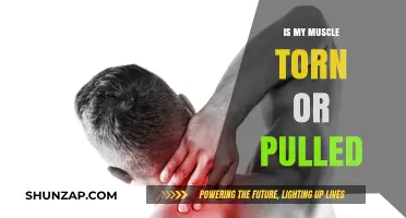 Torn vs. Pulled Muscle: Understanding the Difference and Symptoms
