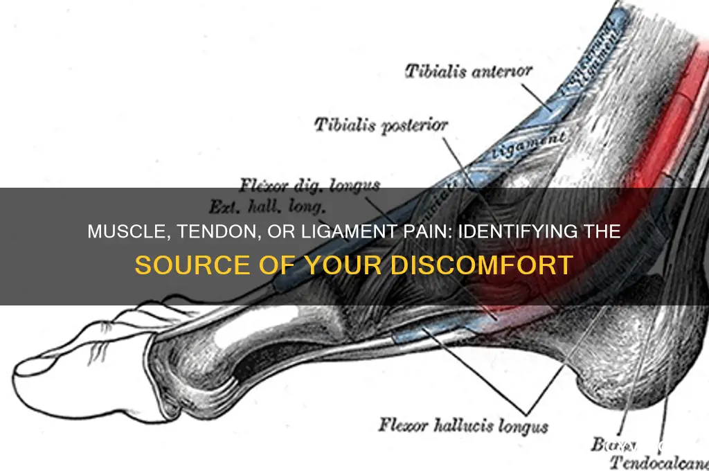 is my pain muscle or tendon or ligament