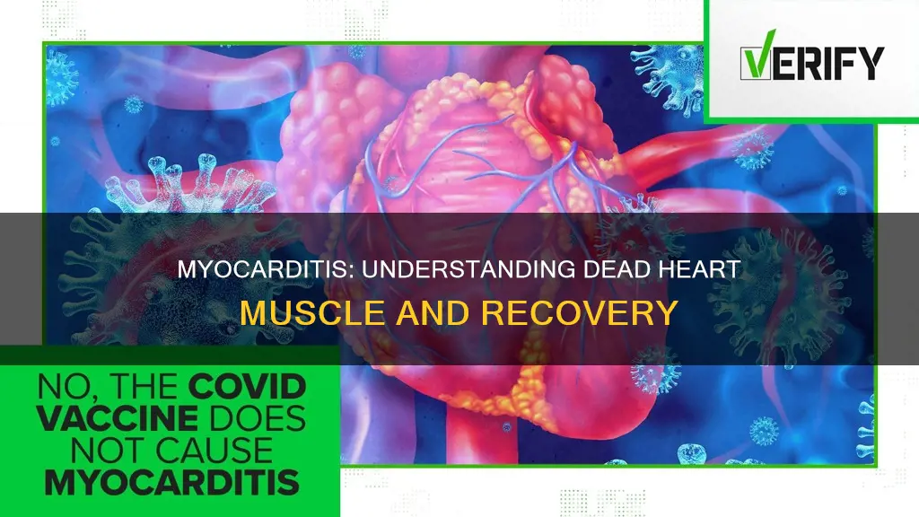 is myocarditis dead heart muscle