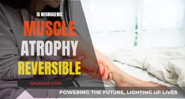 Reversing Neurogenic Muscle Atrophy: What You Need to Know