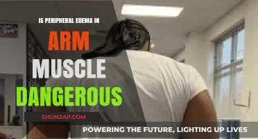 Peripheral Edema in Arm Muscles: Risks, Symptoms, and When to Worry