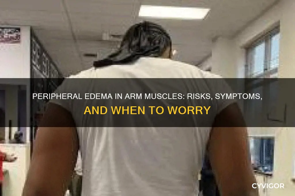 is peripheral edema in arm muscle dangerous