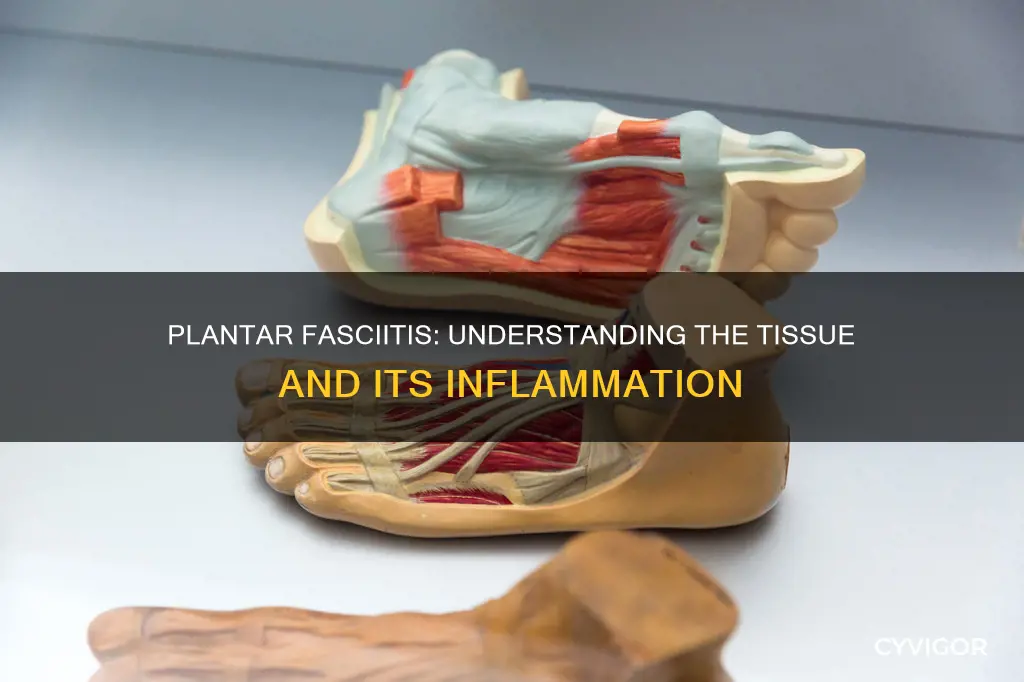 is plantar fasciitis a muscle