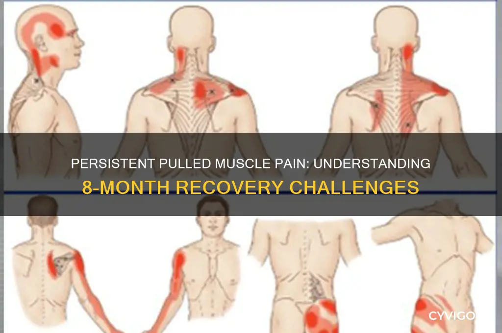 is pulled muscle pain after 8 months