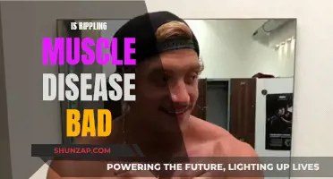 Rippling Muscle Disease: A Serious and Rare Condition