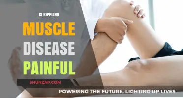 Is Rippling Muscle Disease Painful? Understanding Symptoms and Management