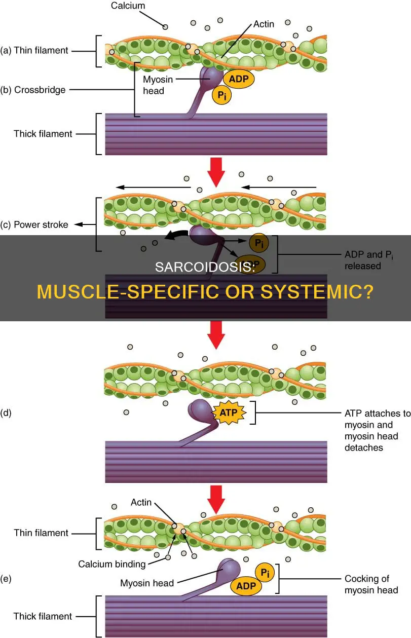 is sarco specific to muscle