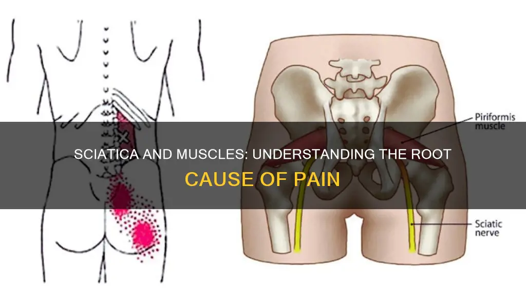 is sciatica a muscle