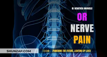 Sciatica Unveiled: Understanding the Source of Muscle vs. Nerve Pain