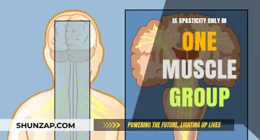 Is Spasticity Isolated to Single Muscle Groups? Exploring the Facts
