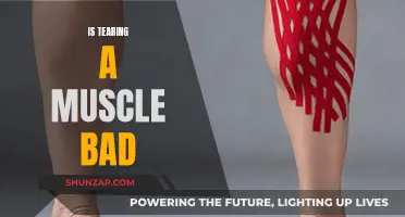 Tearing a Muscle: How Bad is it?