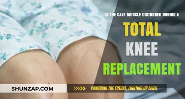 Impact of Total Knee Replacement on Calf Muscle: What You Need to Know