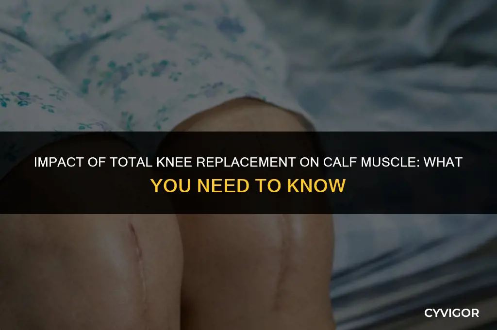 is the calf muscle disturbed during a total knee replacement