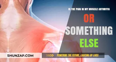 Muscle Pain: Arthritis or Another Condition? Understanding the Difference