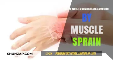Wrist Muscle Sprains: A Frequent Injury Explained