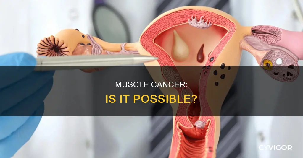 is ther cancer of muscles