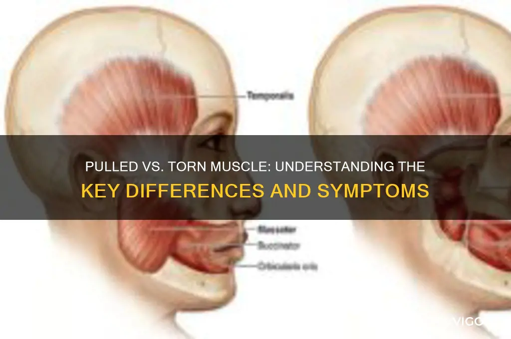 is there a difference between pulled and torn muscle