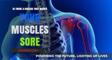 Muscle Soreness: Could It Be a Hidden Medical Condition?