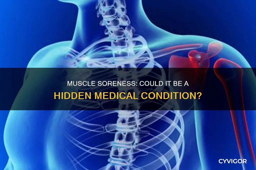 is there a disease that makes your muscles sore