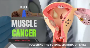 Muscle Cancer: Is it Real or a Myth?