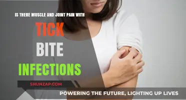 Tick Bite Infections: Unraveling Muscle and Joint Pain Symptoms