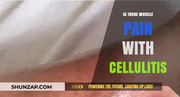 Does Cellulitis Cause Muscle Pain? Understanding Symptoms and Relief