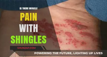 Shingles and Muscle Pain: Understanding the Connection and Symptoms