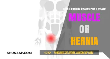 Burning, Bulging Pain: Pulled Muscle or Hernia? How to Tell