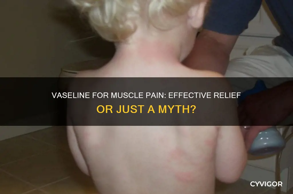 is vaseline good for muscle pain