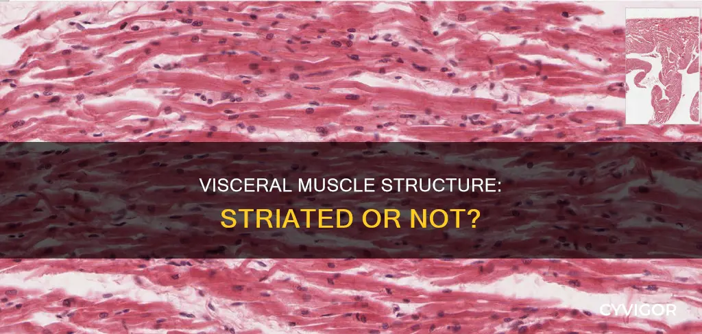 is visceral muscle striated