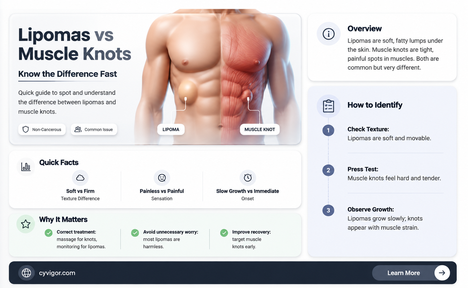 are lipomas muscle knots