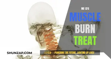 Treating ME/CFS: Soothing the Burn