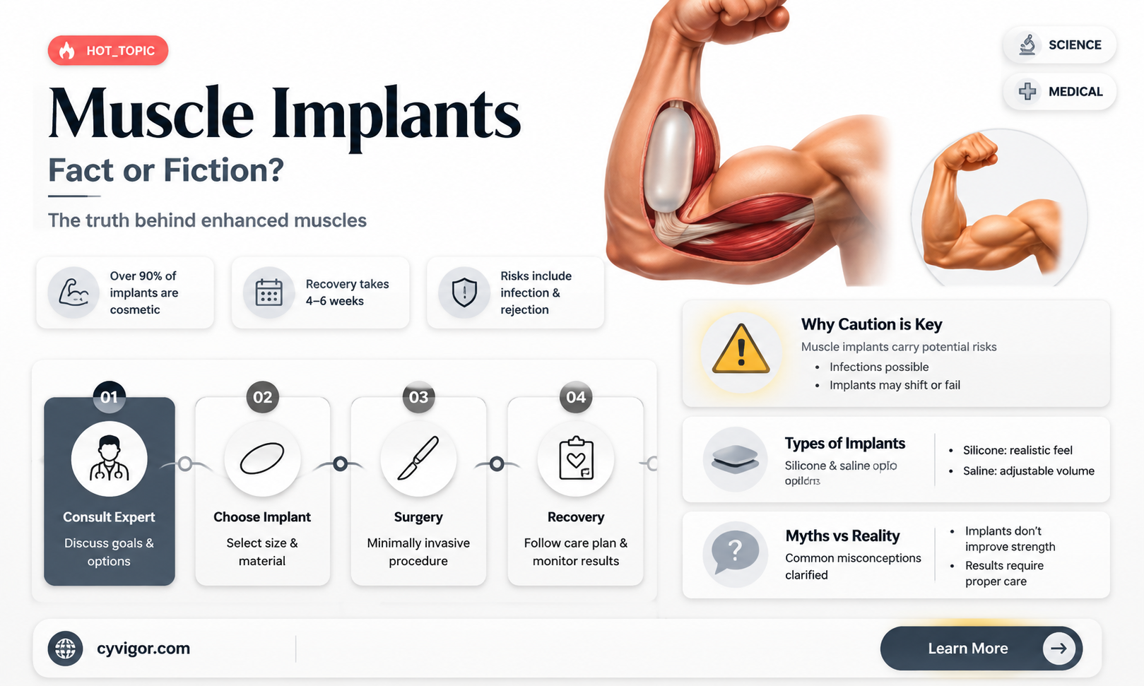 are muscle implants real