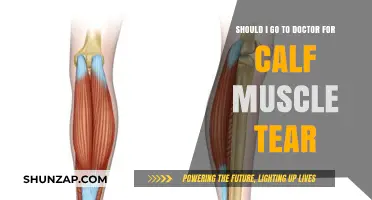 Navigating Calf Muscle Tears: When to Seek Medical Help