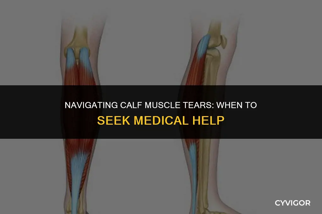 should i go to doctor for calf muscle tear