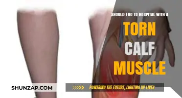 Torn Calf Muscle: When to Seek Hospital Care