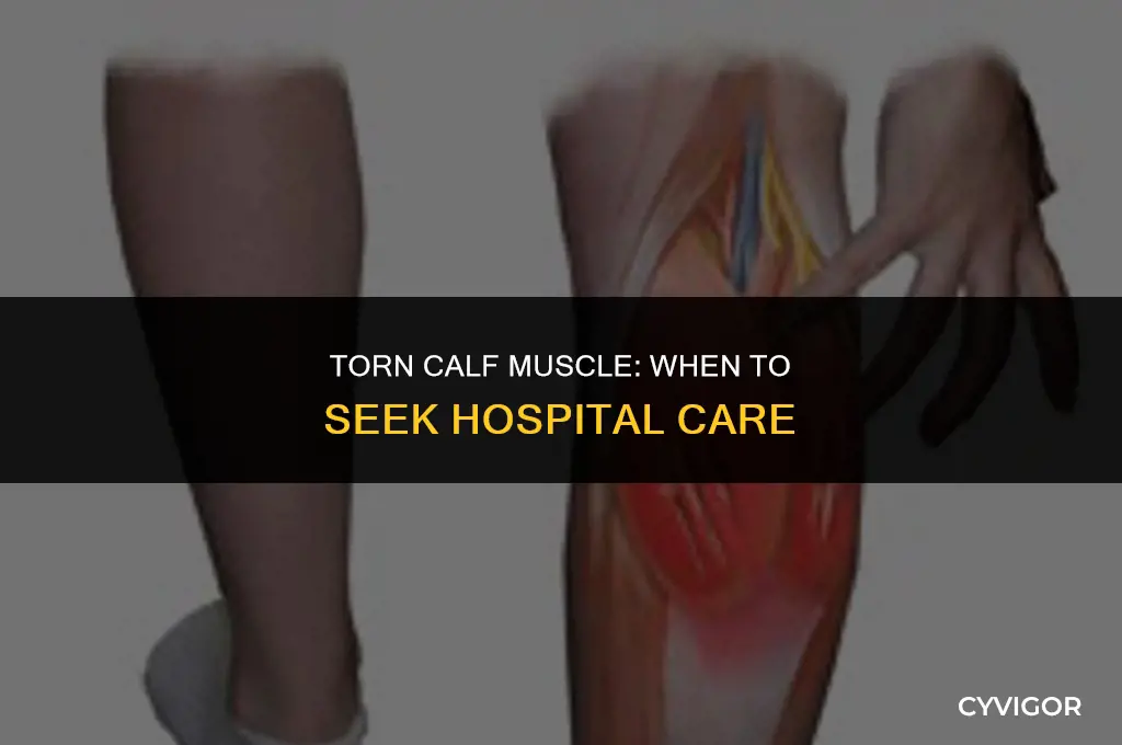 should i go to hospital with a torn calf muscle