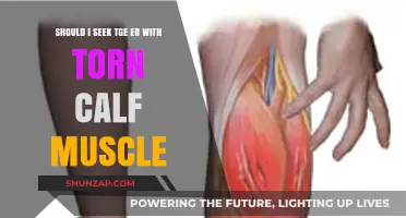 Torn Calf Muscle: When to Seek Emergency Care