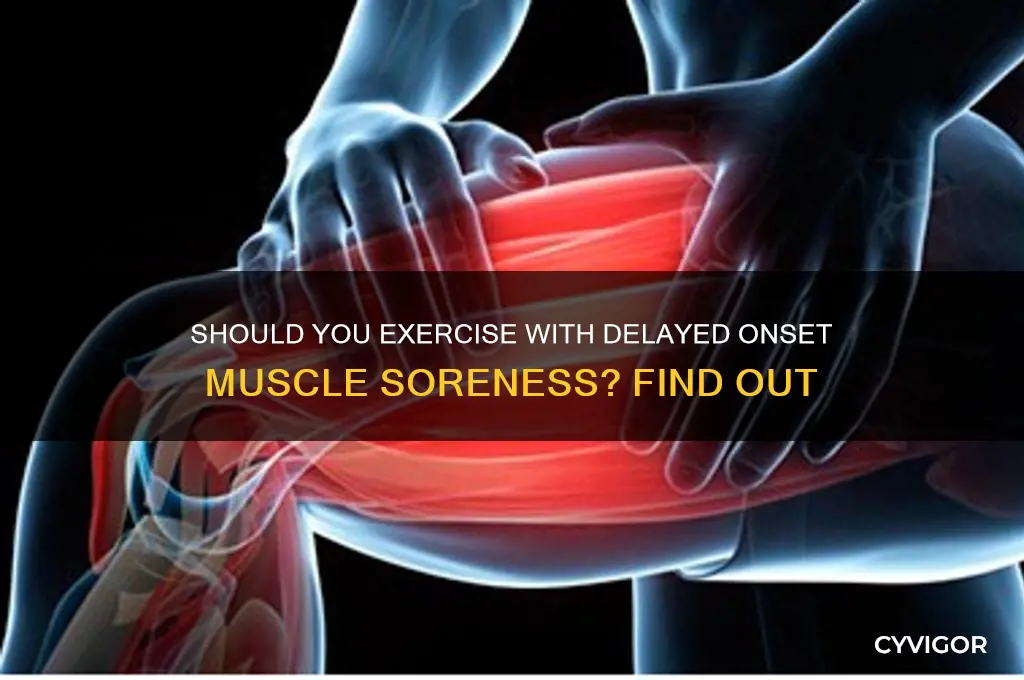 should i still work out with delayed onset muscle soreness