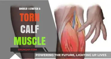Torn Calf Muscle: To Stretch or Not to Stretch?