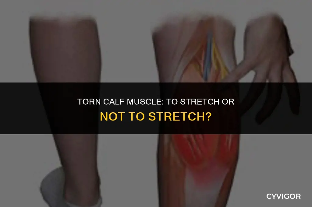 should i stretch a torn calf muscle