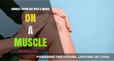 Working Out with a Bruised Muscle: Safe or Risky Move?