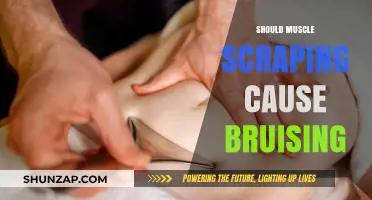 Muscle Scraping: Bruising and What It Means